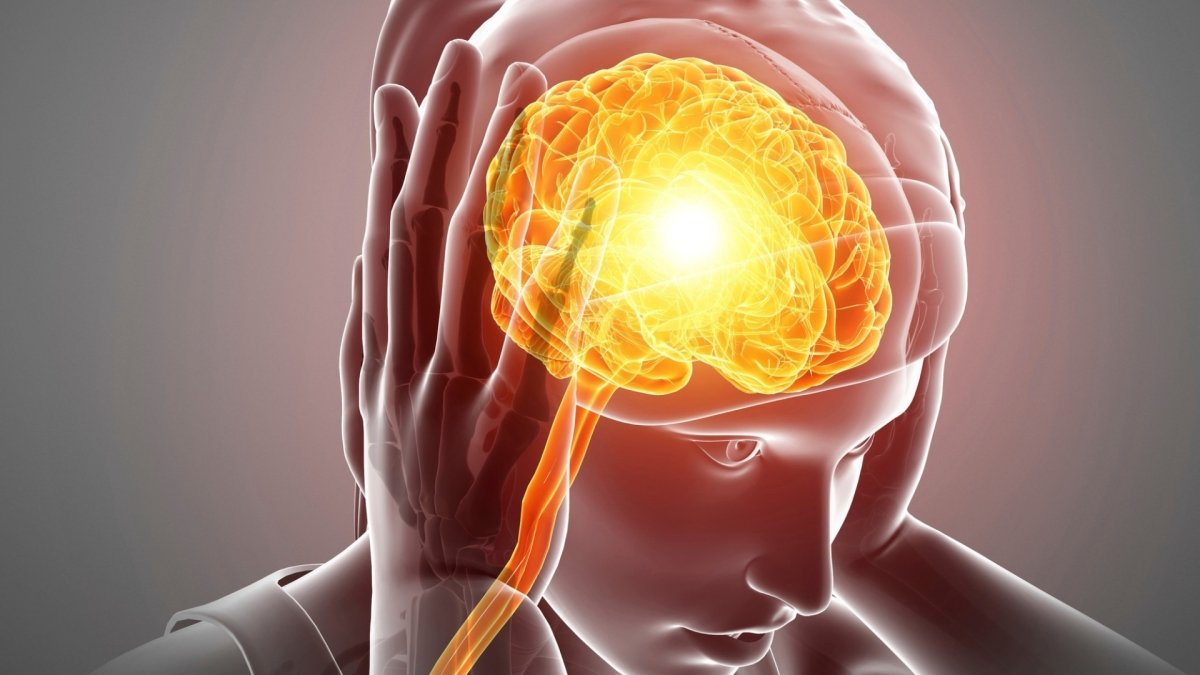 Migraine - Symptoms and Causes - Headachecap.com.au